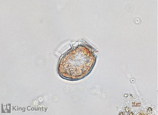 Photo of Dinophysis acuminata